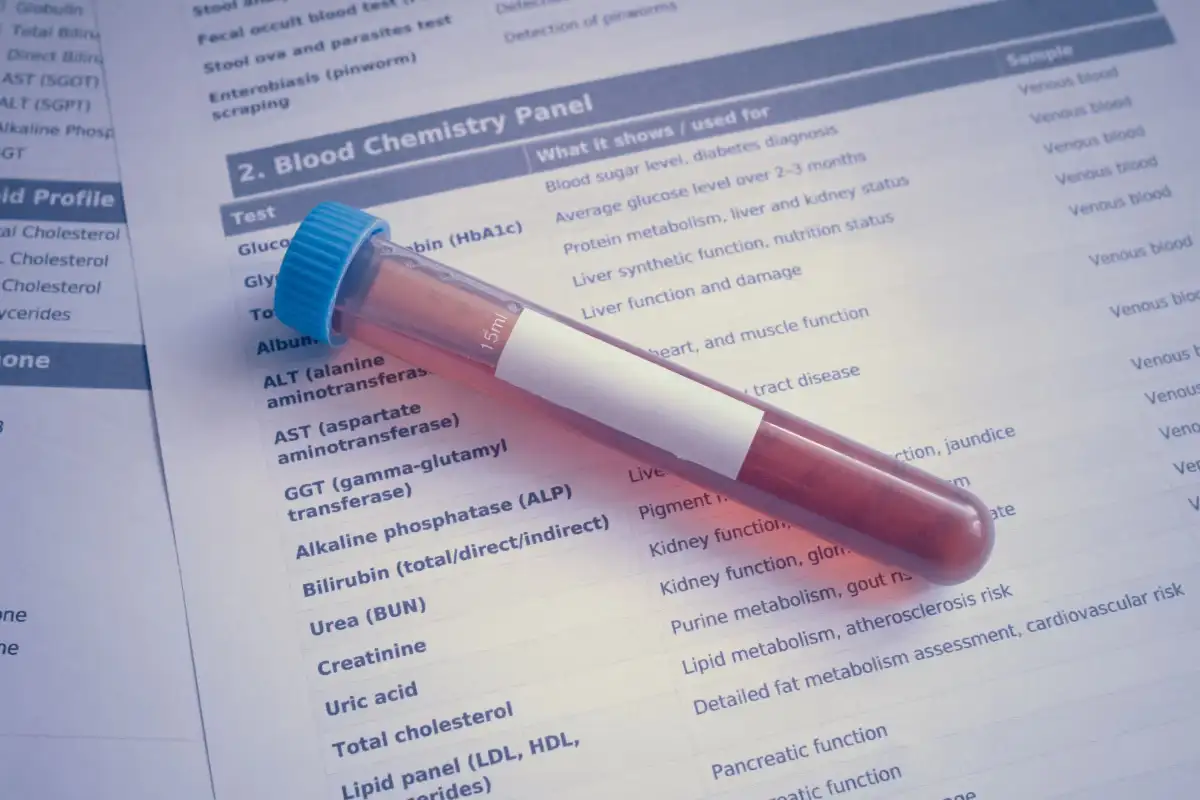 Free Family Heart Foundation Cholesterol Screening Kit: Order & Test at Home Nationwide (Excl. NY)